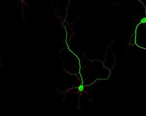 CIL:36174, Rattus, multipolar neuron