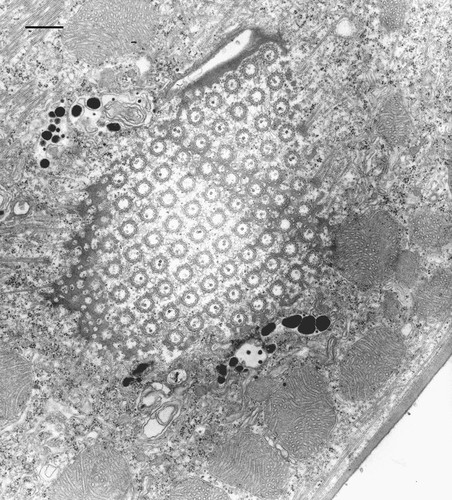 CIL:9909, Euplotes sp., cell by organism, eukaryotic cell, Eukaryotic Protist, Ciliated Protist