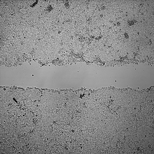 CIL:43415, Mus musculus, mammary adenocarcinoma