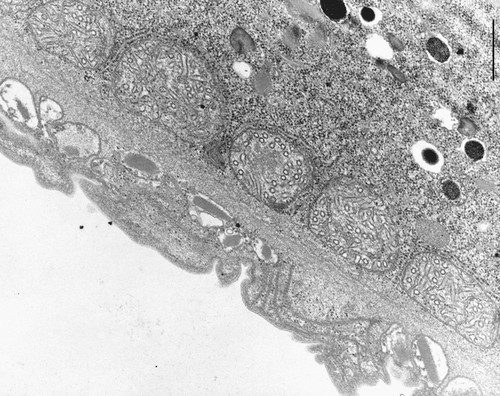 CIL:10005, Didinium nasutum, cell by organism, eukaryotic cell, Eukaryotic Protist, Ciliated Protist