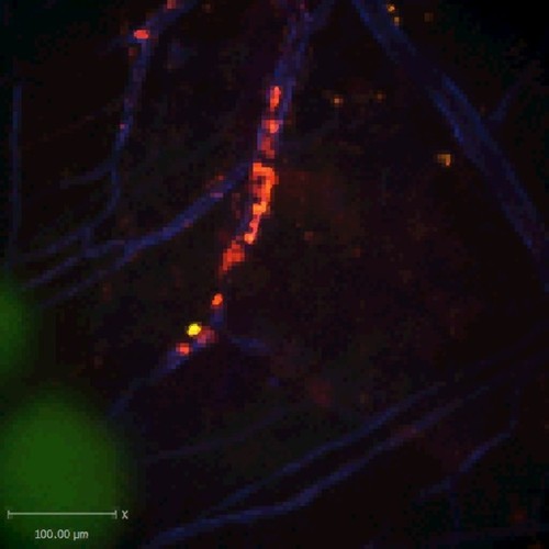 CIL:47548, Staphylococcus aureus, neutrophil, endothelial cell