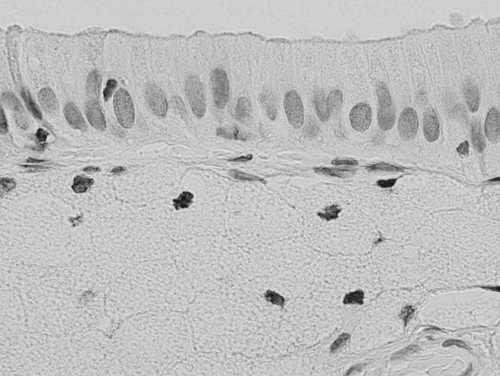 CIL:34859, Homo sapiens, epithelial cell, foam cell