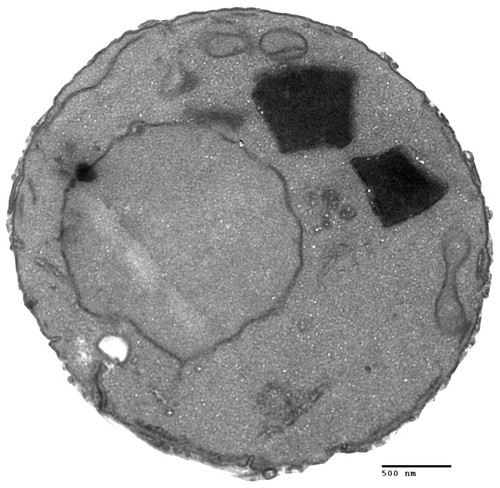 CIL:40450, Saccharomyces cerevisiae, vma9 mutant