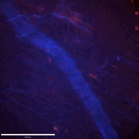 CIL:47601, Staphylococcus aureus, neutrophil, endothelial cell