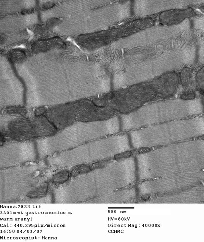 CIL:351, Mus musculus, skeletal muscle cell