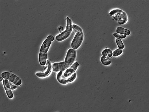 CIL: 54834, Simonsiella muelleri, bacteria