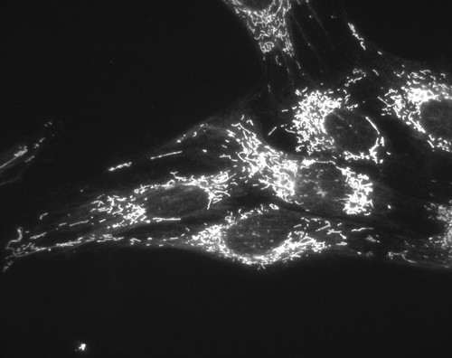 CIL:2, Mus musculus, fibroblast