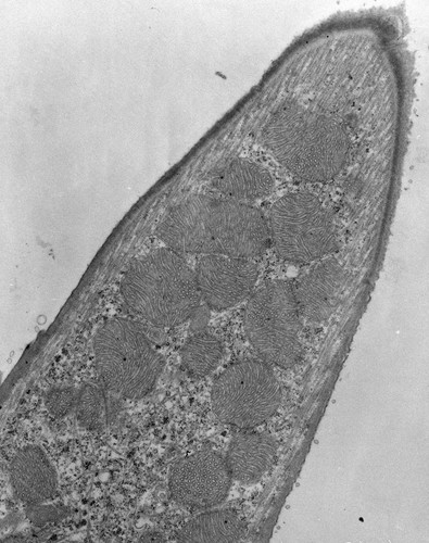 CIL:9707, Euplotes sp., cell by organism, eukaryotic cell, Eukaryotic Protist, Ciliated Protist