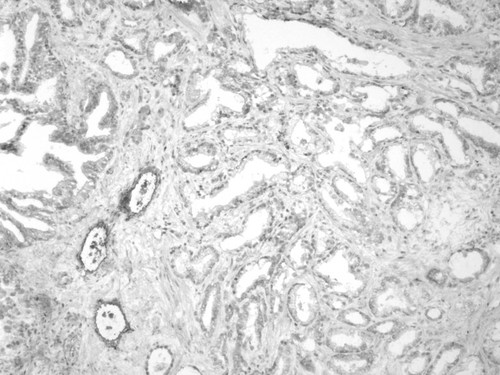 CIL:32206, Homo sapiens, endocrine-paracrine cell of prostate gland, basal cell of prostate epithelium, luminal cell of prostate epithelium, blood vessel endothelial cell, perineural cell, sheath cell, leukocyte, prostate stromal cell, smooth muscle cell of prostate