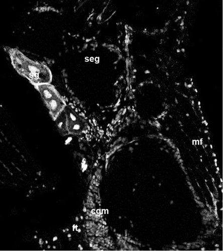 CIL:12585, Spiroplasma kunkelii, Dalbulus maidis, prokaryotic cell, muscle cell, fat cell, secretory cell