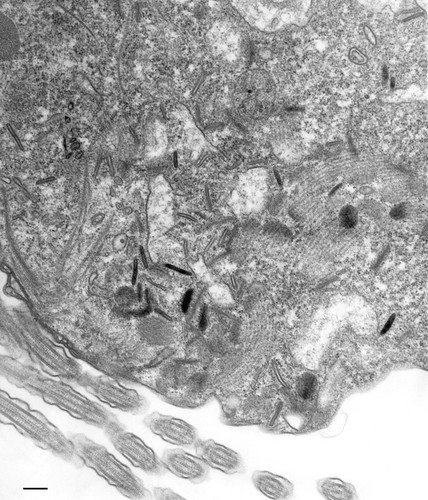 CIL:36706, Paramecium multimicronucleatum, cell by organism, eukaryotic cell, Eukaryotic Protist, Ciliated Protist