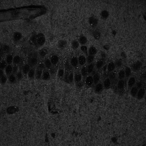 CIL:40142, Mus musculus, CNS neuron (sensu Vertebrata)