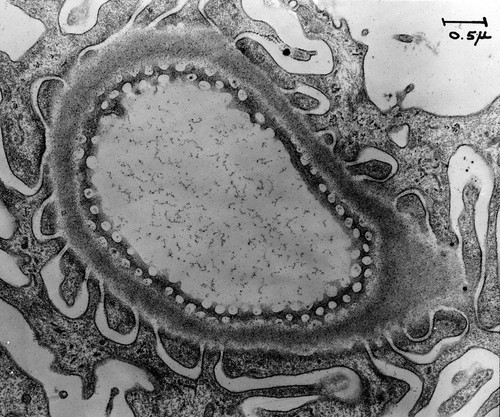 CIL:37182, Rattus, kidney cell, fenestrated cell, glomerular endothelial cell