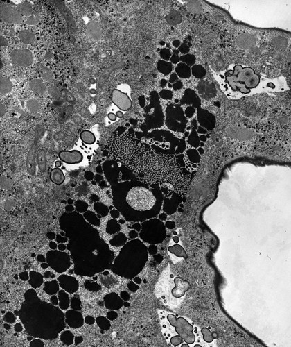 CIL:38871, Euplotes sp., cell by organism, eukaryotic cell, Eukaryotic Protist, Ciliated Protist