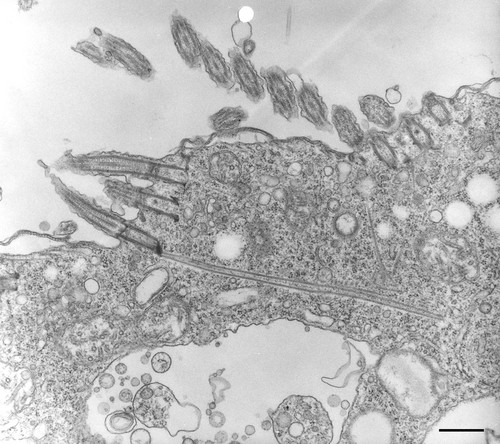 CIL:10274, Halteria grandinella, cell by organism, eukaryotic cell, Eukaryotic Protist, Ciliated Protist