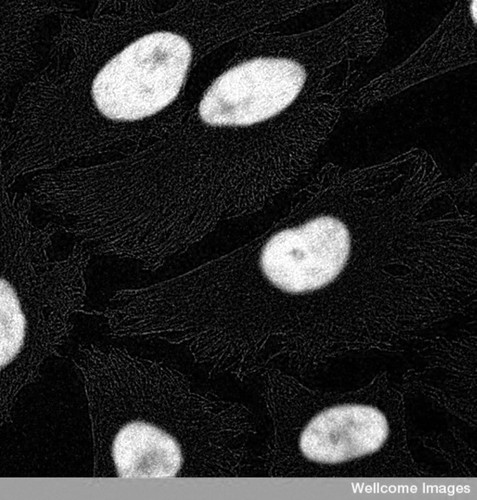 CIL:38912, Homo sapiens, epithelial cell of cervix