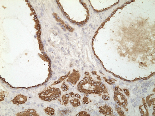 CIL:34264, Homo sapiens, endocrine-paracrine cell of prostate gland, basal cell of prostate epithelium, luminal cell of prostate epithelium, blood vessel endothelial cell, perineural cell, sheath cell, leukocyte, prostate stromal cell, smooth muscle cell of prostate