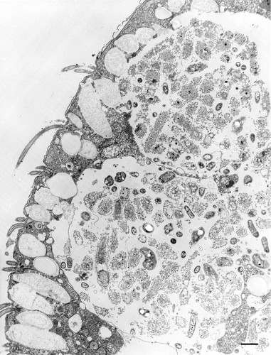 CIL:12103, Colpoda cucullus, cell by organism, eukaryotic cell, Eukaryotic Protist, Ciliated Protist