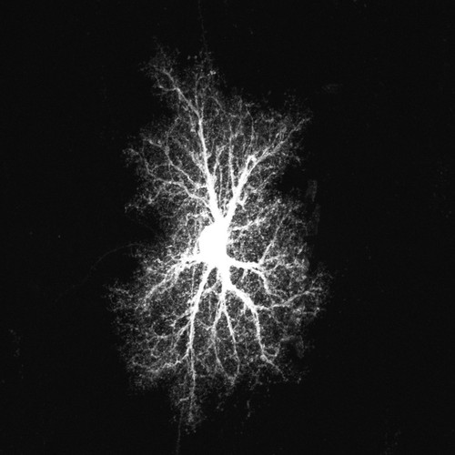 CIL:36353, Rattus norvegicus, astrocyte, astrocyte of the hippocampus