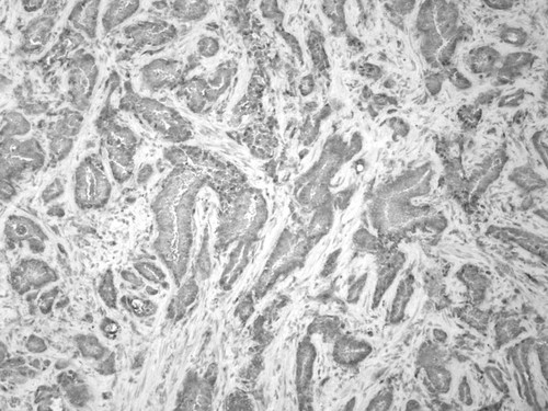 CIL:32394, Homo sapiens, endocrine-paracrine cell of prostate gland, basal cell of prostate epithelium, luminal cell of prostate epithelium, blood vessel endothelial cell, perineural cell, sheath cell, leukocyte, prostate stromal cell, smooth muscle cell of prostate