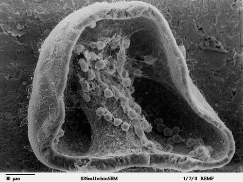 CIL:39784, Lytechinus pictus, mesenchymal cell