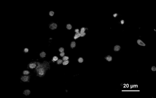 CIL:25365, Maize mosaic virus, Peregrinus maidis, hemocyte (sensu Nematoda and Protostomia)