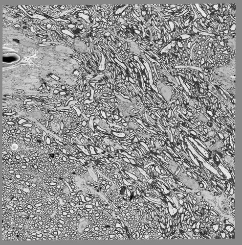 CIL:50581, MiniSOG+ ipRGC axon labeling in the optic nerve (ON)