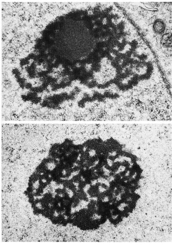 CIL:11027, Didelphimorphia, spermatogonium