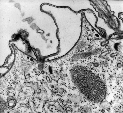 CIL:12612, Paramecium multimicronucleatum, cell by organism, eukaryotic cell, Eukaryotic Protist, Ciliated Protist