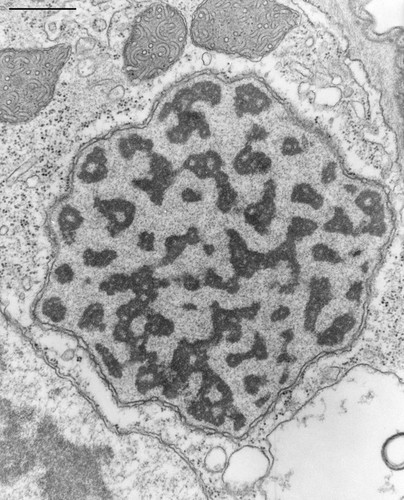 CIL:9921, Opercularia [NCBITaxon:168247], Opercularia coarctata, cell by organism, eukaryotic cell, Eukaryotic Protista, Ciliated Protista