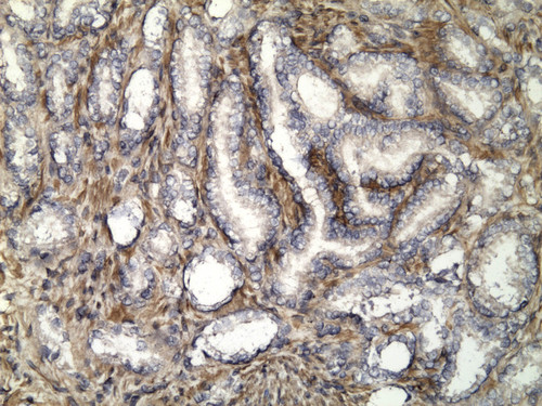 CIL:33355, Homo sapiens, endocrine-paracrine cell of prostate gland, basal cell of prostate epithelium, luminal cell of prostate epithelium, blood vessel endothelial cell, perineural cell, sheath cell, leukocyte, prostate stromal cell, smooth muscle cell of prostate