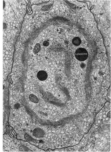CIL:11378, Leporidae, epithelial cell