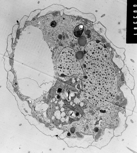 CIL:38828, Coleps hirtus, eukaryotic cell, Eukaryotic Protist, Ciliated Protist