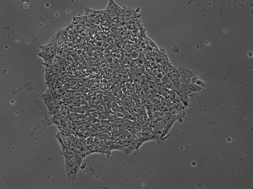 CIL:12626, Homo sapiens, stem cell