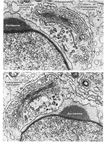 CIL:11372, Chinchilla, spermatid