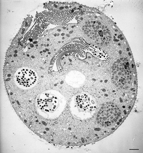 CIL:36250, Vorticella convallaria, cell by organism, eukaryotic cell, Eukaryotic Protist, Ciliated Protist