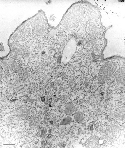 CIL:36230, Tetrahymena pyriformis, cell by organism, eukaryotic cell, Eukaryotic Protist, Ciliated Protist