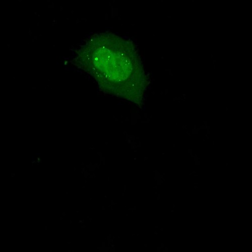 CIL:13922, Homo sapiens, permanent cell line cell