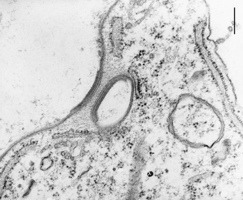 CIL:9715, Coleps hirtus, eukaryotic cell, Eukaryotic Protist, Ciliated Protist