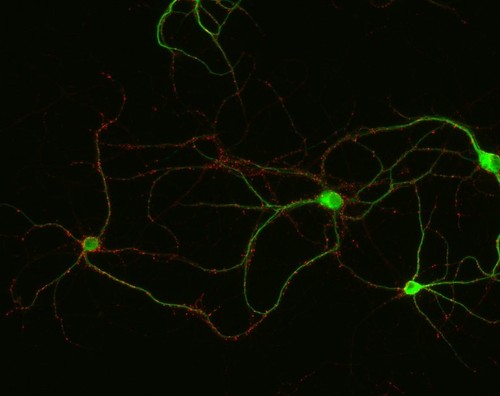 CIL:12555, Rattus, multipolar neuron