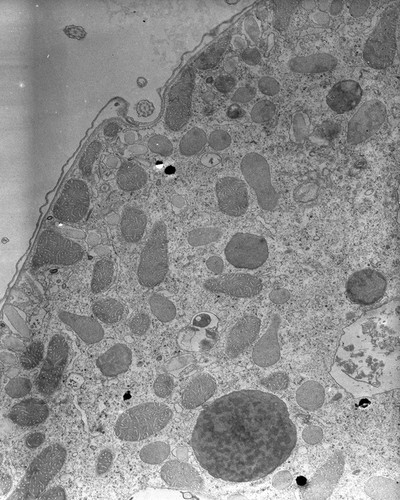 CIL:34534, Tetrahymena pyriformis, cell by organism, eukaryotic cell, Eukaryotic Protist, Ciliated Protist