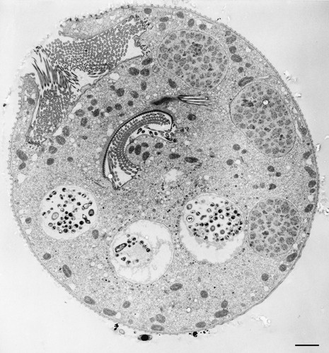 CIL:36251, Vorticella convallaria, cell by organism, eukaryotic cell, Eukaryotic Protist, Ciliated Protist