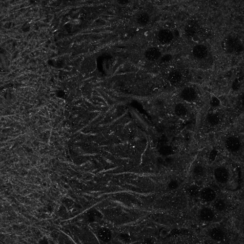 CIL:40155, Mus musculus, CNS neuron (sensu Vertebrata)