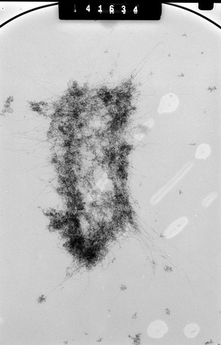 CIL:40691, Mus musculus, fibroblast