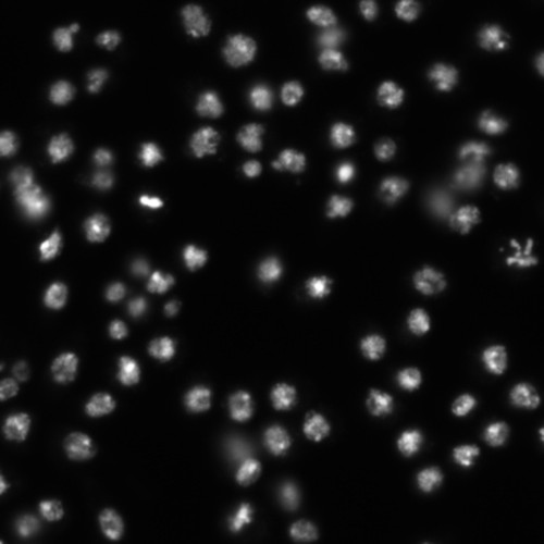 CIL:32143, Drosophila melanogaster, epithelial cell