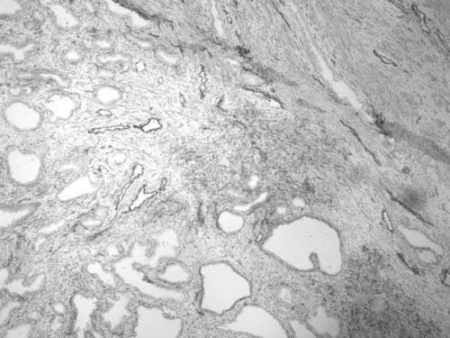 CIL:33980, Homo sapiens, endocrine-paracrine cell of prostate gland, basal cell of prostate epithelium, luminal cell of prostate epithelium, blood vessel endothelial cell, perineural cell, sheath cell, leukocyte, prostate stromal cell, smooth muscle cell of prostate