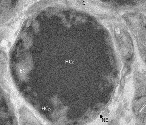 CIL:39742, Mus musculus, retinal rod cell