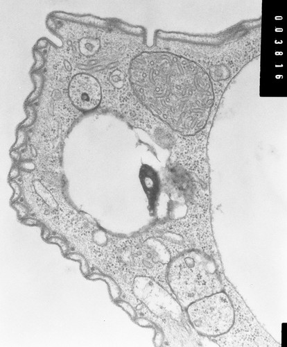 CIL:7336, Opercularia [NCBITaxon:168247], Opercularia coarctata, cell by organism, eukaryotic cell, Eukaryotic Protist, ciliated Protist
