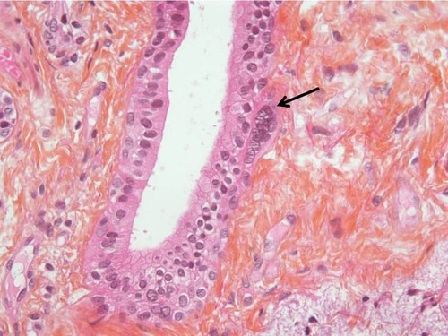 CIL: 53281, Homo sapiens, basal cell