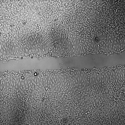 CIL:43404, Mus musculus, mammary adenocarcinoma